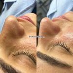 آموزشگاه و مرکز تخصصی پوست و موی قم