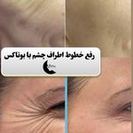 کلینیک زیبایی و لیزر سلن مشهد