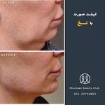 کلینیک پوست  و مو موتاکس