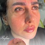 مطب پوست و لیزر