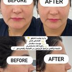 کلینیک زیبایی و لاغری شادرما