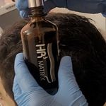 درمان مشکلات کف سر و ضخیم ساقه بهاره