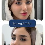 کلینیک زیبایی و جوانسازی پوست و مو الین