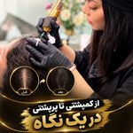 اولین مرکز اسکراپ و میکرواسکالپ در مشهد