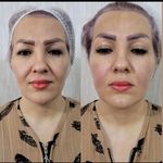 کلینیک زیبایی و لاغری شادرما