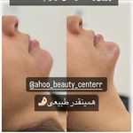 کلینیک لیزر آهو (مرکز لیزر موهای زائد)
