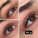 مرکز میکروبلیدینگ مهرطب اصفهان