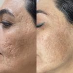 فیشال و خدمات پاکسازی پوست  فاطمه انامی