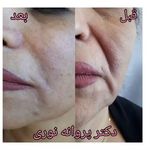 کلینیک زیبایی مرکز لیزر دکترپروانه نوری