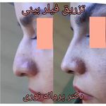 کلینیک زیبایی مرکز لیزر دکترپروانه نوری