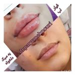 کلینیک زیبایی مرکز لیزر دکترپروانه نوری