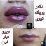 کلینیک زیبایی مرکز لیزر دکترپروانه نوری