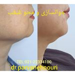 کلینیک زیبایی مرکز لیزر دکترپروانه نوری