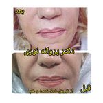 کلینیک زیبایی مرکز لیزر دکترپروانه نوری