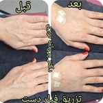 کلینیک زیبایی مرکز لیزر دکترپروانه نوری
