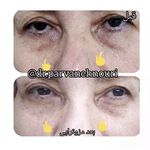 کلینیک زیبایی مرکز لیزر دکترپروانه نوری