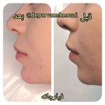 کلینیک زیبایی مرکز لیزر دکترپروانه نوری