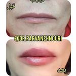 کلینیک زیبایی مرکز لیزر دکترپروانه نوری