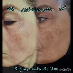 کلینیک زیبایی مرکز لیزر دکترپروانه نوری