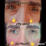 کلینیک زیبایی مرکز لیزر دکترپروانه نوری