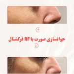 مرکز لیرز و جوانسازی پوست شهربانو