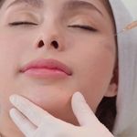 مرکز لیرز و جوانسازی پوست شهربانو