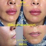 کلینیک زیبایی مرکز لیزر دکترپروانه نوری