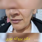 کلینیک زیبایی مرکز لیزر دکترپروانه نوری
