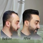 کلینیک زیبایی بلژو