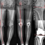 شکسته بندی، طب سنتی استادحکیم