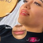 مرکز لیزر ،پوست و زیبایی کندی بیوتی