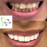 دندانپزشکی دکتر آزاده خلجیان