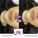 کلینیک زیبایی آنا بیوتی