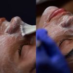خدمات تخصصی هیدرو فیشال صورت نومه لوکس