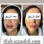 کلینیک زیبایی و لیزر دکتر آزاده اسماعیلی