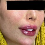 کلینیک زیبایی خانم محمدرضایی پوست ومو