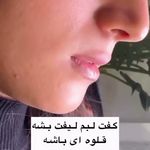 کلینیک زیبایی خانم محمدرضایی پوست ومو