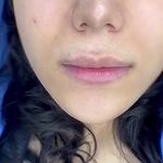 کلینیک زیبایی خانم محمدرضایی پوست ومو