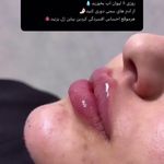 مطب زیبایی خانم محمدرضایی پوست ومو