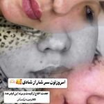 مطب زیبایی خانم محمدرضایی پوست ومو