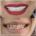 مطب دندان پزشکی لبخند شیرین