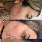 سالن پاکسازی پوست و فیشال تینا