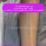مرکز لیزر و کلینیک زیبایی لیزرلند