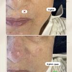 مرکز لیزر ،پوست و زیبایی کندی بیوتی