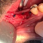 مركز ايمپلنت و زيبايى دکتر آنيتا کاظمى