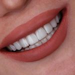 مركز ايمپلنت و زيبايى دکتر آنيتا کاظمى