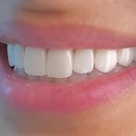 مركز ايمپلنت و زيبايى دکتر آنيتا کاظمى