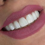 مركز ايمپلنت و زيبايى دکتر آنيتا کاظمى