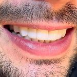 مركز ايمپلنت و زيبايى دکتر آنيتا کاظمى