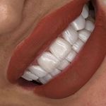 مركز ايمپلنت و زيبايى دکتر آنيتا کاظمى